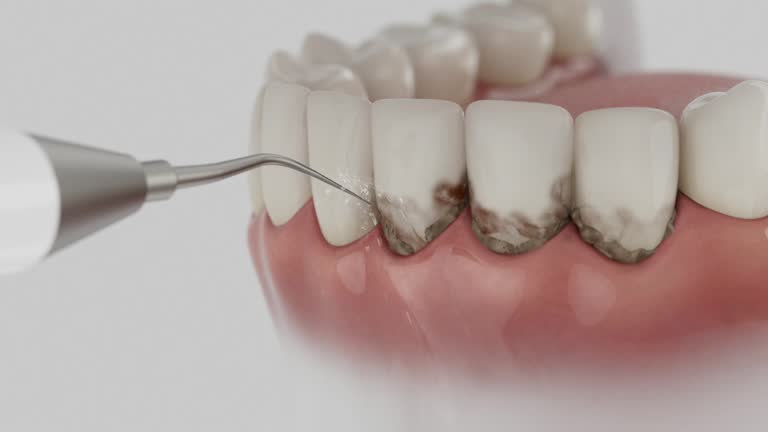 Trusted Wisdom Tooth Removal service in Algood, TN - Dentist Open Now